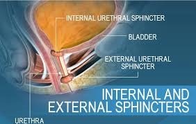 Erkekte Yapay Sfinkter